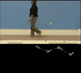 Gait Analysis